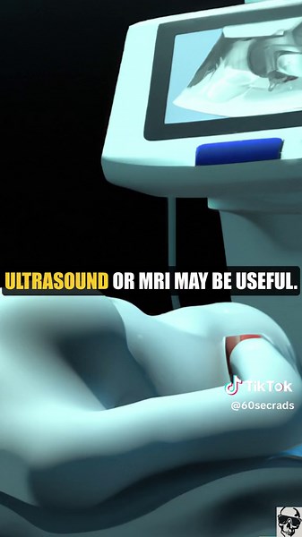 Mammo Localization #radiology #rads #mammography #mammo #mammogram #breastcancer #diagnostic #breastmri #breastultrasound #MRI #CT #ultrasound #screening #invasiveductalcarcinoma #IDC #ductalcarcinomainsitu #DCIS #coreradiology #coreexam #diagnosticradiology #residency#Radiologist #RadiologyEducation #RadiologyResidency #RadiologyStudents #RadiologyLife #DiagnosticImaging #Radiography #MedicalResidency #RadiologyTech #PACS #RadiologyTraining #MedicalStudents #DigitalImaging #MedicalEducation #Im