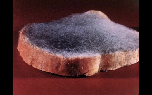 显微镜下的黑根霉（面包霉）