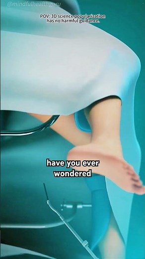 IUD insertion Process（3D Animation）