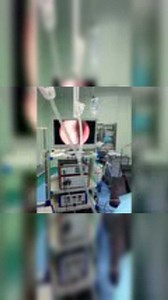 前列腺电切手术