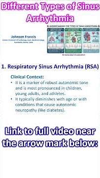 Different Types of Sinus Arrhythmia