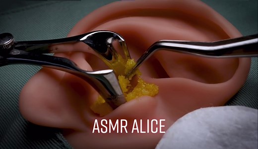 ASMR 特殊器具で耳を掃除しましょう【ロールプレイ、両耳同時】 #earcleaning #asmr #asmralice #音フェチ #asmrvideo