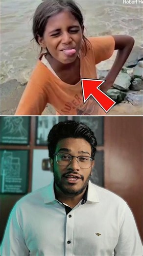 From Slum Princess to Star Model! 😱🔥 Maleesha Kharwa Story #shorts #facts #motivation