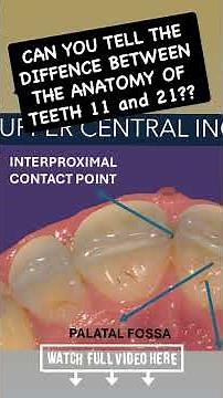 Tooth Morphology & Dental Anatomy (ALL cusps, fissures, grooves, marginal ridges) #dentalanatomy