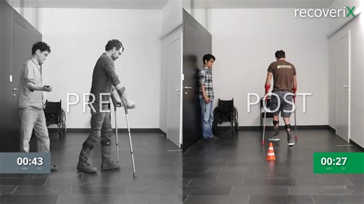 After only 18 hours of work. Before and after recoveriX 😍😍 g.tec's neurorehabilitation solution draws on 25 years of expertise in Brain-Computer Interface (BCI) technology. These achievements have been made possible by recoveriX, a neurorehabilitation system designed for stroke, multiple sclerosis (MS), and Parkinson's patients. The system is medically certified, safe, and effective, and is currently used in more than 20 countries worldwide. Patients are required to imagine motor movements 6,0