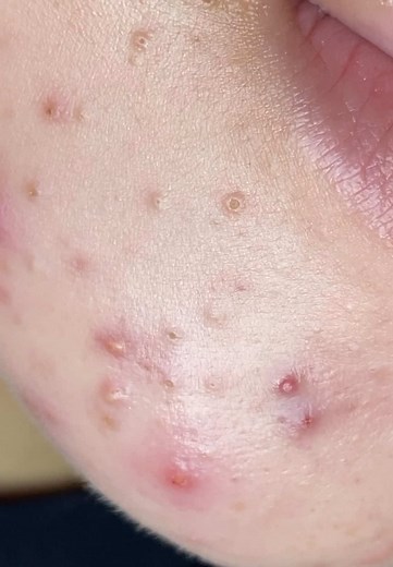 SAC DEP SPA trên TikTok