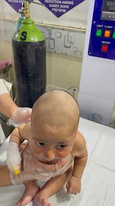 Cute baby barfing, also called spitting up, is very common—especially after feeding. It usually happens because a baby’s tummy is still developing or a little air was swallowed during the feed. Small, effortless spit-ups are normal and harmless. Gentle burping and keeping the baby upright after feeding can help reduce it, while those tiny milk smiles still melt hearts. | Neonatal Hub