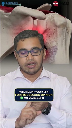 Reverse Shoulder Replacement vs Shoulder Arthroscopy – What’s the Difference? | Dr. Reeta Explains