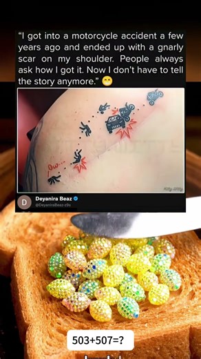 "I got into a motorcycle accident a fewyears ago and ended up with a gnarlyscar on my shoulder.