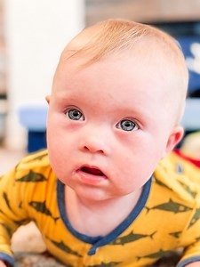 They are found in up to 52% of children with Down syndrome! No wonder his eyes are so mesmerizing 💙💛 #downsyndrome #downsyndromeawareness | Tamra Roney