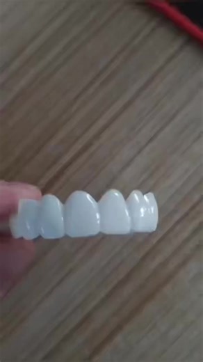 Braces Transformation: 1 Year Update | Braces Before And After