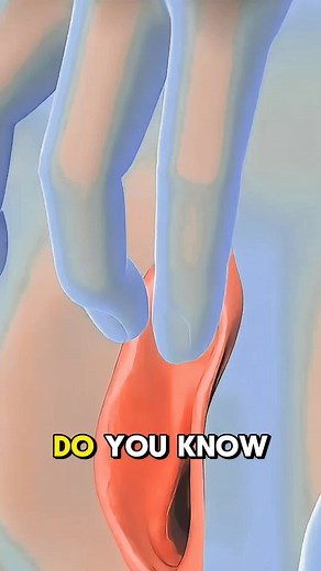 Vaginal Pessary Ring Procedure 3D Animation #pessaryring #pelvichealth #pelvicpain #pelvicorgans #healthcare #medicalfield #medicalschool #medicalanimation #medicalstudent #medicaltiktok #healthyliving