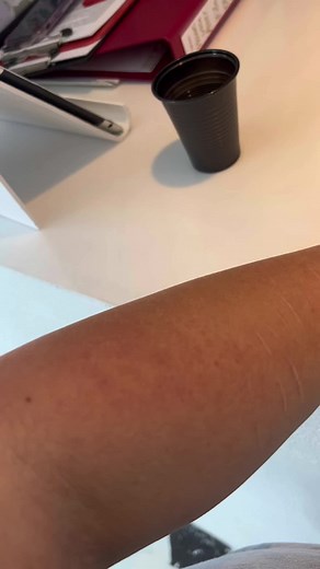 nezuko tattoo, i‘m totally in love! thanks to @danikastattoo 💖 #fy #fypシ #nezuko #tattoo #anime #demonslayer