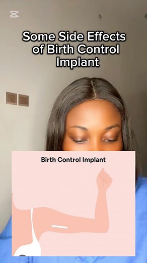 11K views · 36 reactions | Common side effects of birth control implant. #Birthcontroloptions #implantsystem #birthcontrolimplant #preventpregnancy #contraceptiveawareness #hormonalcontraception | Giftfavour’world | Facebook