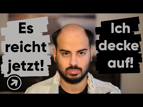 Toupee experience | Fed up with the hairpiece after 2 years | Hair loss