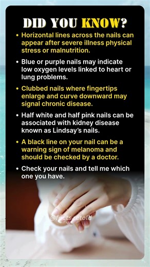 Your Nails Can Reveal Serious Health Problems