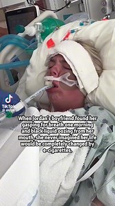 Quit smoking! Vape is not an option! CTTO #vape #smoke #RIP | Xtine InMadrid