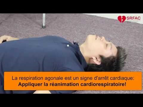 Respiration agonale ou Gasping