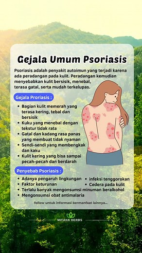 Gejala Umum Psoriasis: Penyakit Kulit yang Harus Diketahui