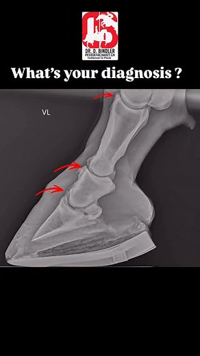 Eine Arthrose muss heute nicht das Ende des beschwerdefreien Lebens des Pferdes bedeuten. Wir haben heute viele Möglichkeiten, diesen Patienten gezielt zu helfen. Bei diesem Pferd wurde vor fünf Jahren die letzte Behandlung der stark veränderten Zehengelenke durchgeführt. Die Behandlung bestand aus der Behandlung der Gelenke direkt und einer systemischen Medikation, welche Knochenschmerz lindert. Weiter wurde ein orthopädischer Beschlag angebracht, um die Kräfte in den geschädigten Gelenken mögl