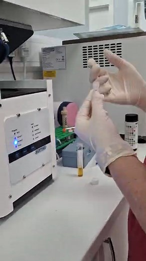 🧫 Ever wondered what happens when your pet’s urine sample is tested at the vet? Here's Student Nurse Georgia performs a full in-house urine analysis to help check your pet’s health from the inside out! 🐶🐱 Here’s what’s involved: 🔹 Dipstick Test – checks for things like protein, glucose, blood, and pH levels. 🔹 Refractometer – measures how concentrated the urine is, giving us clues about kidney function and hydration. 🔹 Microscopic Examination – allows us to look for cells, crystals, and ba