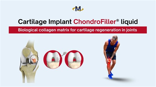 Cartilage Implant ChondroFiller liquid