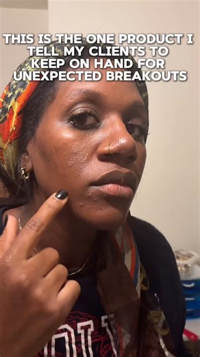 This is one product I recommend every acne client keep on hand for breakout emergencies. I personally keep GlyMed Plus Sulfur Masque in my routine and use it only as a spot product when breakouts pop up. Another favorite I trust is Face Reality Skincare Sulfur Spot Treatment. Why sulfur earns a permanent spot: • Helps calm inflamed breakouts • Visibly reduces redness and swelling • Targets acne without stripping the skin • Acne-safe and suitable for sensitive skin • Supports control of breakout-