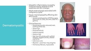 Skin in Systemic Disease: A Specialised Overview