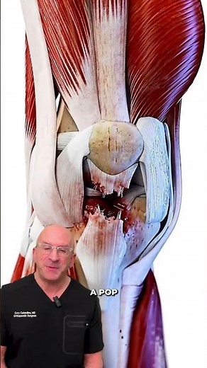 When your kneecap literally snaps off #injury #knee #medical