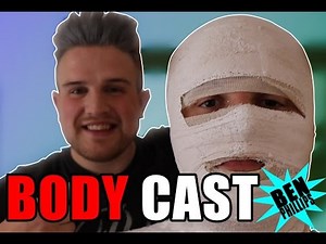 My bro had a skin transplant! **PRANK!**