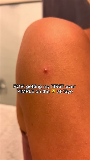 This is the change you've been looking for in your skin health, it is a miracle in a bottle! #skinissues #fyp #viral #mymagichealer