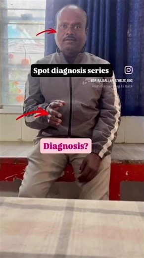 Spot diagnosis series #ytshorts #cmbbs #shortvideo #mbbs #tremor