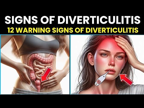 12 Warning Signs of Diverticulitis You Should Never Ignore!