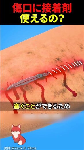 What would happen if you put glue on a wound?