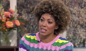 Dr Zoe advises against calamine lotion for chickenpox