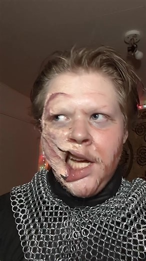 Understanding Prosthetic Techniques for Beginners