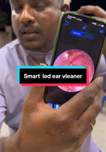 Smart Ear Cleaner with Bluetooth Technology Features