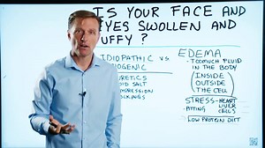 In this video, I explain how to fix a swollen and puffy face. | Dr. Eric Berg