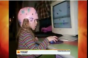 Girl lives with half her brain.