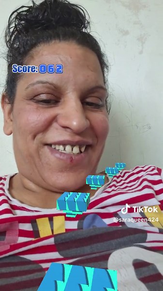 Creative Scoring System Explained with Striped Shirt