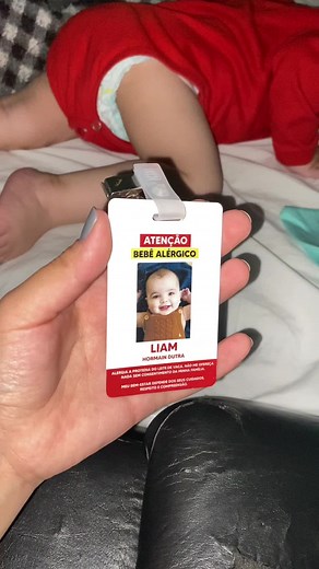 Liam está internado e trouxe comigo nosso crachá, tem muitas doenças que não são visíveis aos olhos e precisam ser alertadas! APLV é coisa séria, uma gota pode desencadear uma super reação colocando ele em perigo. Nos meus destaques do app vizinho tem um chamado CRACHÁ que tem a arte DE GRAÇA para vocês usarem, tem em CorelDraw, Word, PDF e imagem. Espero que seja útil por aí 🤍 #aplv #alergiaalimentar