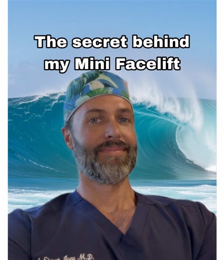 I reveal the reason why my mini facelifts and neck lifts look better than everyone else’s. All jokes aside - a mini facelift is almost never the answer. The face is best corrected in a comprehensive fashion no matter what your age is. #minifacelift #mininecklift