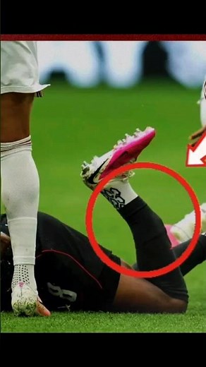 🚨 PLAYER'S LEG BROKEN DURING CANADA vs QATAR WORLD CUP MATCH! 😱💔