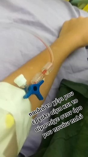 Understanding IV Lines: A Close-Up View