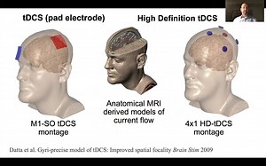 Marom Bikson | High-Definition Transcranial Direct Current Stimulation (HD-tDCS)
