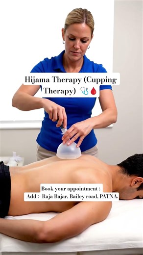 Hijama Therapy (Cupping Therapy) | Benefits, Types, and Clinical Perspective 🩺🩸