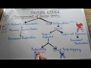 Management of dental caries lec -7