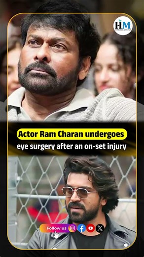 Actor Ram Charan undergoes eye surgery after an on-set injury #ramcharan #eyeinjury #hyderabadmail