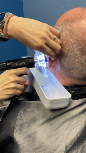 Nice and clean ears thanks to Dr. Kim and the earigator #earigator #waxremoval #satisfying #earwaxremoval #orovalleyaudiology