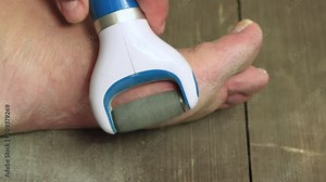 An electric grater cleans the foot. Keratinization and thickening of the epidermis in the plantar surface of the feet. Foot care concept. Isolated video, copy space, close-up. UHD 4K.